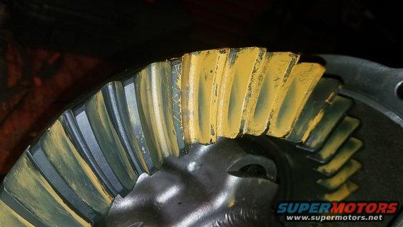 0.020" pinion