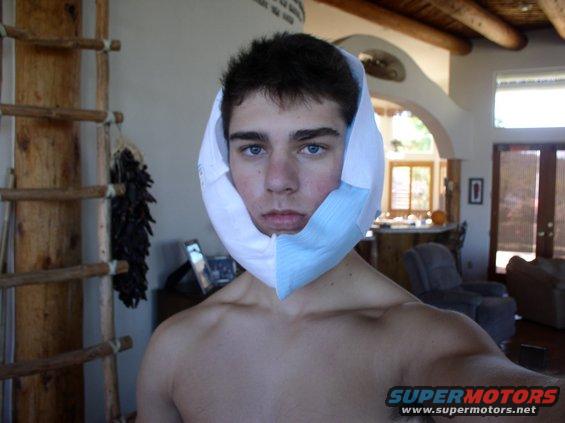 Man with a white and blue bandage wrapped around his jaw and head
