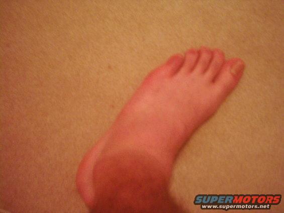 Human foot with toes visible, against a textured background