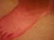 1978 Ford Bronco - A close-up view of a foot, possibly sunburned, resting on a textured surface.