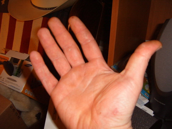 Human hand held up, palm facing camera. American flag pattern visible behind