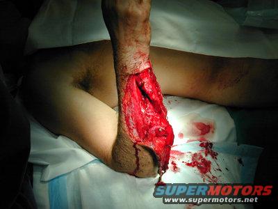 completed20surgery20web.jpg