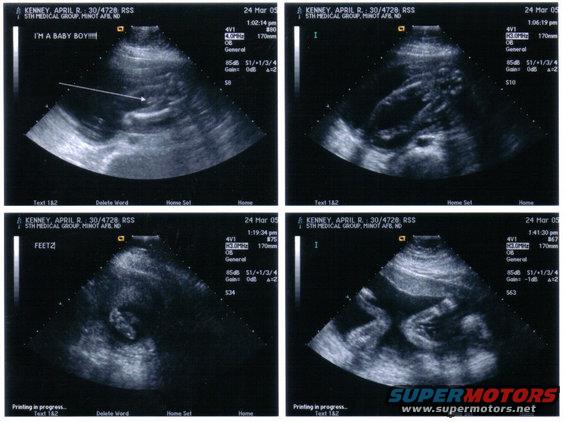 conner-lewis-kenney.jpg its a boy