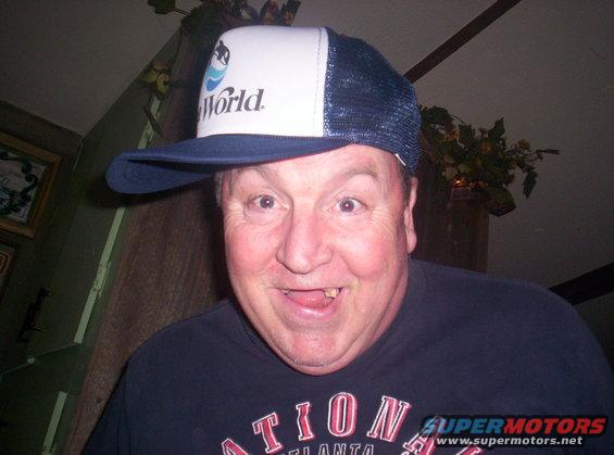 Man with missing teeth wearing a white and blue trucker hat with 'World' and a dolphin logo. He has a dark t-shirt with text