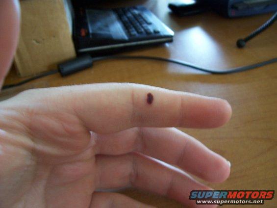 Human finger with a dark mark on it. Supermotors logo visible