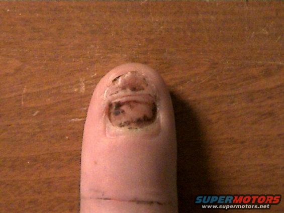 nickcamerapics-001.jpg My smashed finger