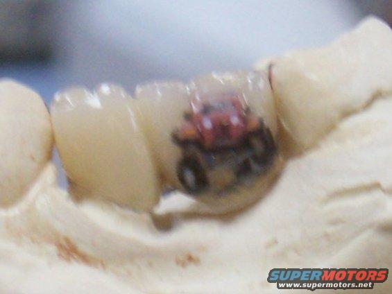 100_0623.jpg my tooth build