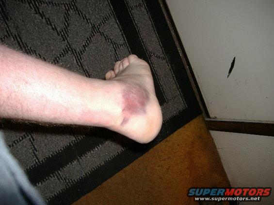ankle-002.jpg 