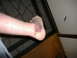 1979 Ford Bronco - A person's ankle shows significant bruising, resting on a patterned rug.