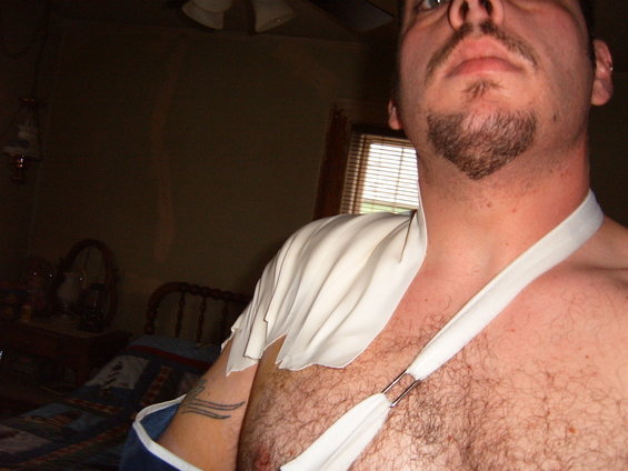 Man wearing a white arm sling over his shoulder, with a tattoo on his arm