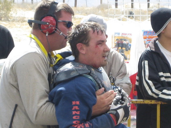Off-road racers in protective gear, one with facial injuries, being attended to. Text on shirt reads 'HANCOCK'