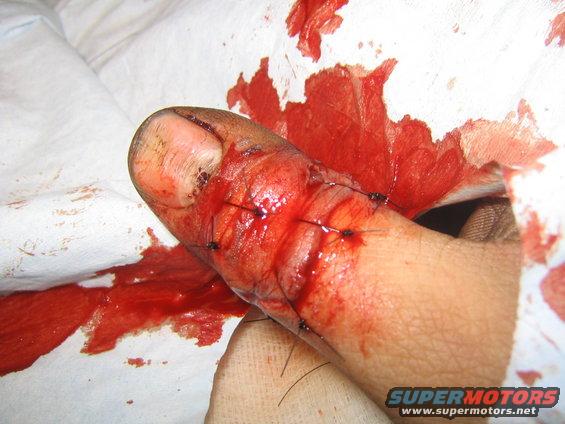 thumb4.jpg