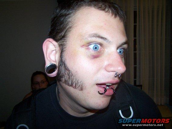 Man with black eye, gauges, and facial piercings