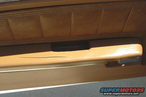Drivers arm rest