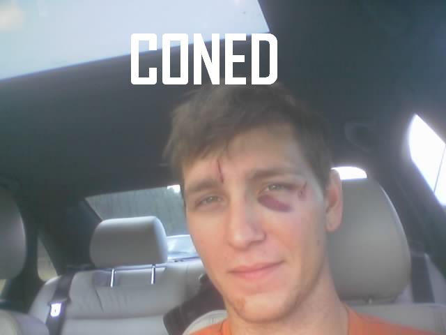 Man with black eye and cut on forehead inside a car, text 'CONED' overlaid