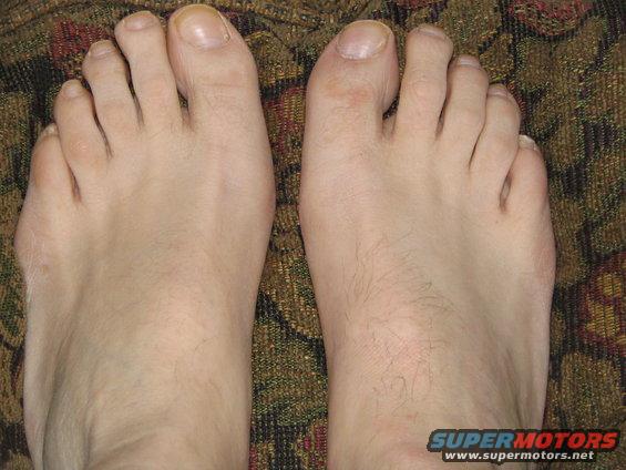 Two human feet with toenails and light hair on a patterned background. Supermotors.net logo in lower right