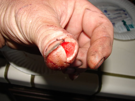 dsc00497.jpg When flesh meets grinder,,,,,,