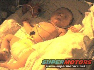 newborn baby with medical tubes and wires in an incubator