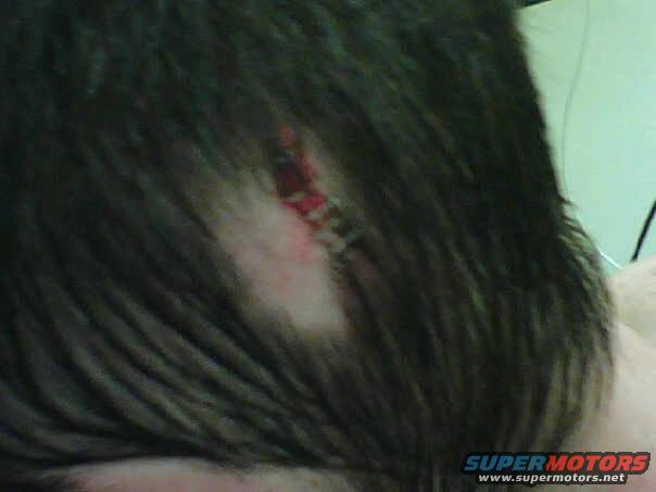 6-staples.jpg