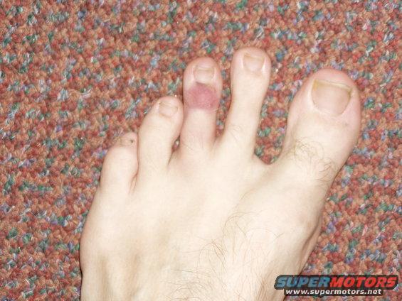 p1010045.jpg Beautiful Toe 2