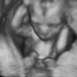 1996 Ford Probe - This is an ultrasound image, not a vehicle photo, despite the website text.
