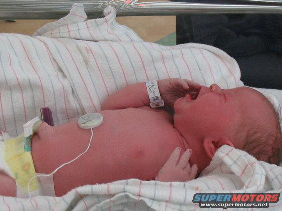 Newborn baby with hospital bracelet and monitoring equipment crying on a blanket