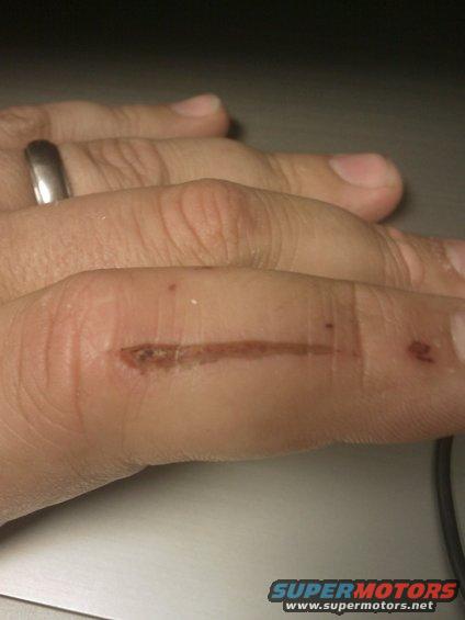 imag0209.jpg Only injury of the weekend.  this is why you should wear leather gloves when using a grinder with no guard.