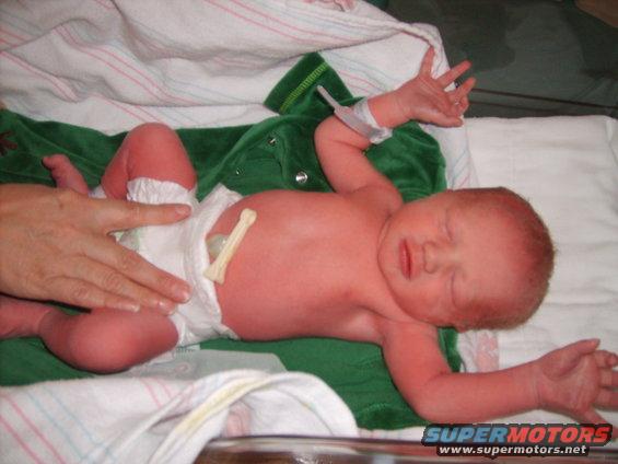 Newborn baby with umbilical cord clamp and hospital bracelet