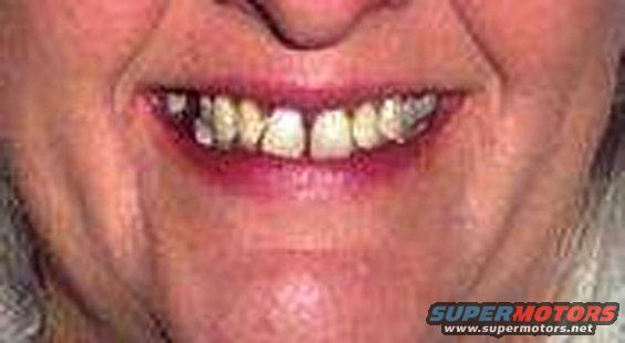 Mouth with visible teeth and "SUPERMOTORS www.supermotors.net" watermark