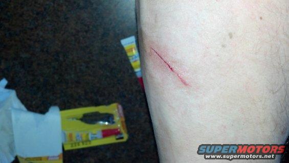 Cut on leg with visible blood, next to a tube of ointment and a blister pack containing a tool