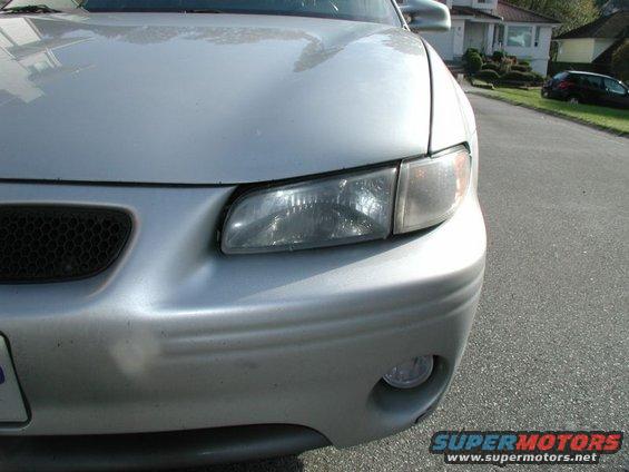 Silver sedan front bumper and headlight, showing a dent on the right side of the bumper