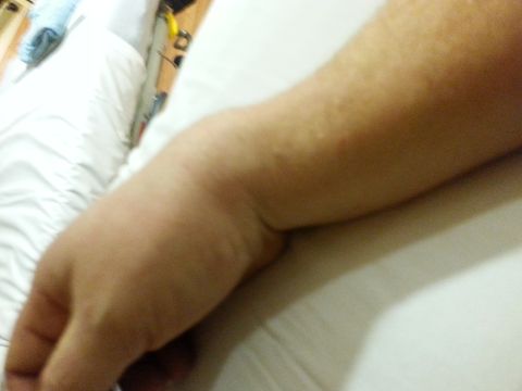 1995 Ford Bronco - A close-up view of a person's arm and hand against a white background.