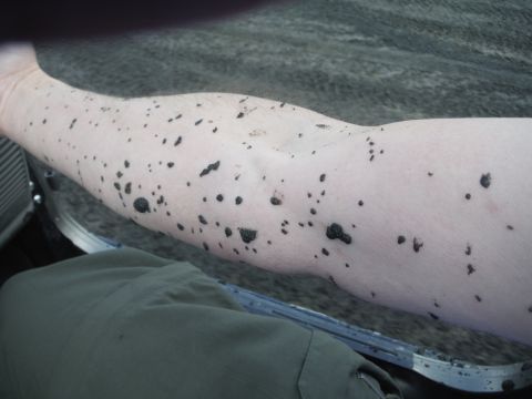 2005 Jeep Wrangler - An arm is covered in numerous black spots, possibly tar, with the Supermotors website logo in the lower right corner.