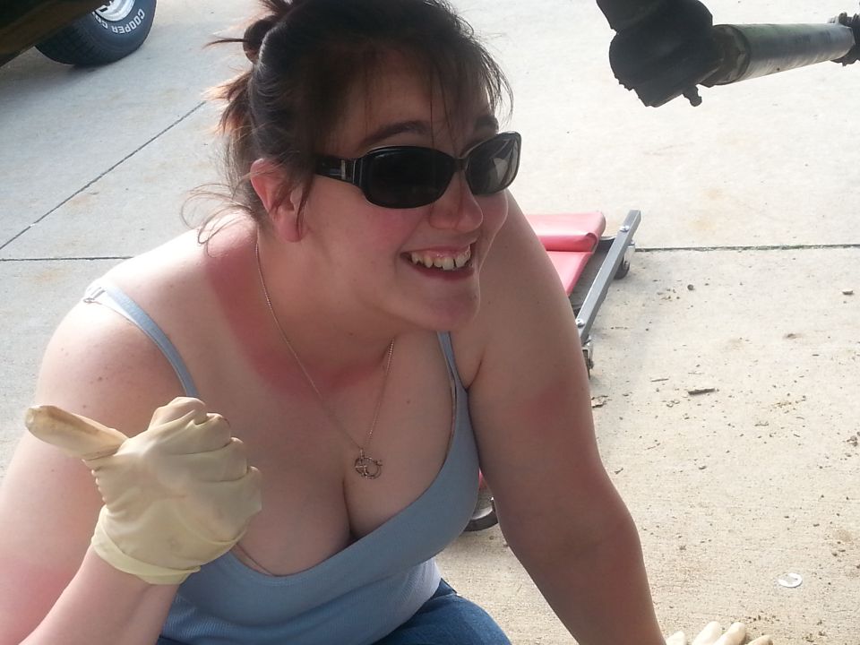 Woman with sunglasses and sunburnt shoulders gives a thumbs up