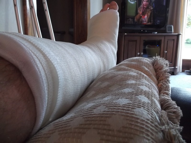 Leg in a white cast resting on a cushion, with crutches and a TV in the background.