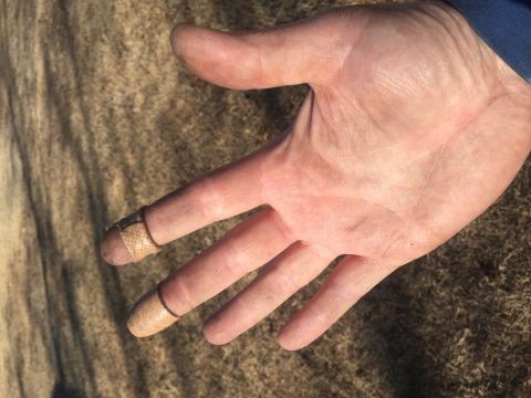 1982 Ford Bronco - A close-up view of a person's left hand with two fingers bandaged. The hand is resting on a textured, sandy surface.
