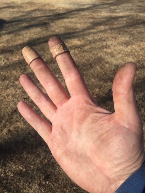 1982 Ford Bronco - A hand with two fingers bandaged is shown against a blurred background of dry grass and shadows.