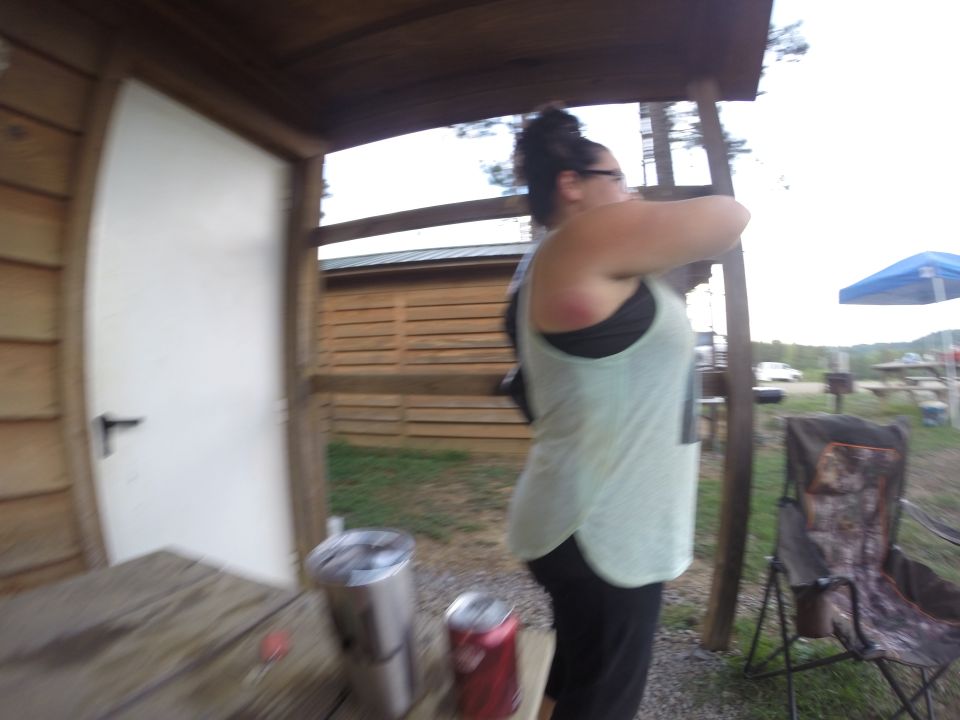 Woman with red mark on shoulder, outdoor scene with wooden structure and chair