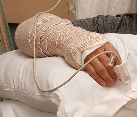 1996 Ford Bronco - A person's arm is bandaged and resting on pillows, with a pulse oximeter attached to their finger.