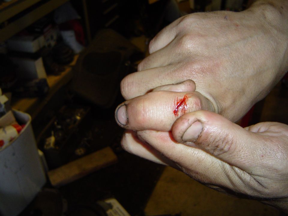 Opps cut my finger inside the oil pan