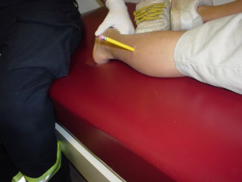 1990 Ford Bronco - A medical professional appears to be examining a pencil stuck in a person's leg.