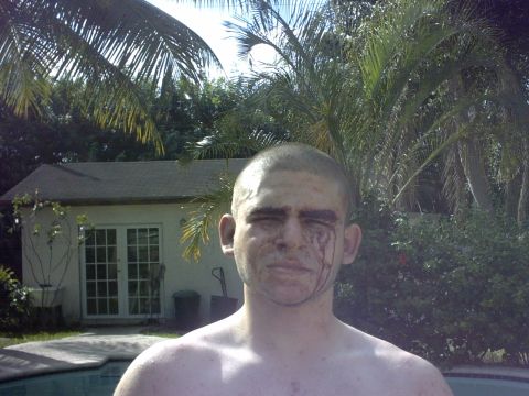 1992 Ford Bronco - A man with blood on his face stands outdoors near a pool and palm trees.