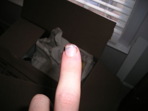 1996 Ford Bronco - Close-up of a finger with a bruised nail, with a cardboard box in the background.