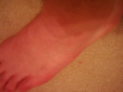 1978 Ford Bronco - A close-up view of a foot, possibly sunburned, resting on a textured surface.
