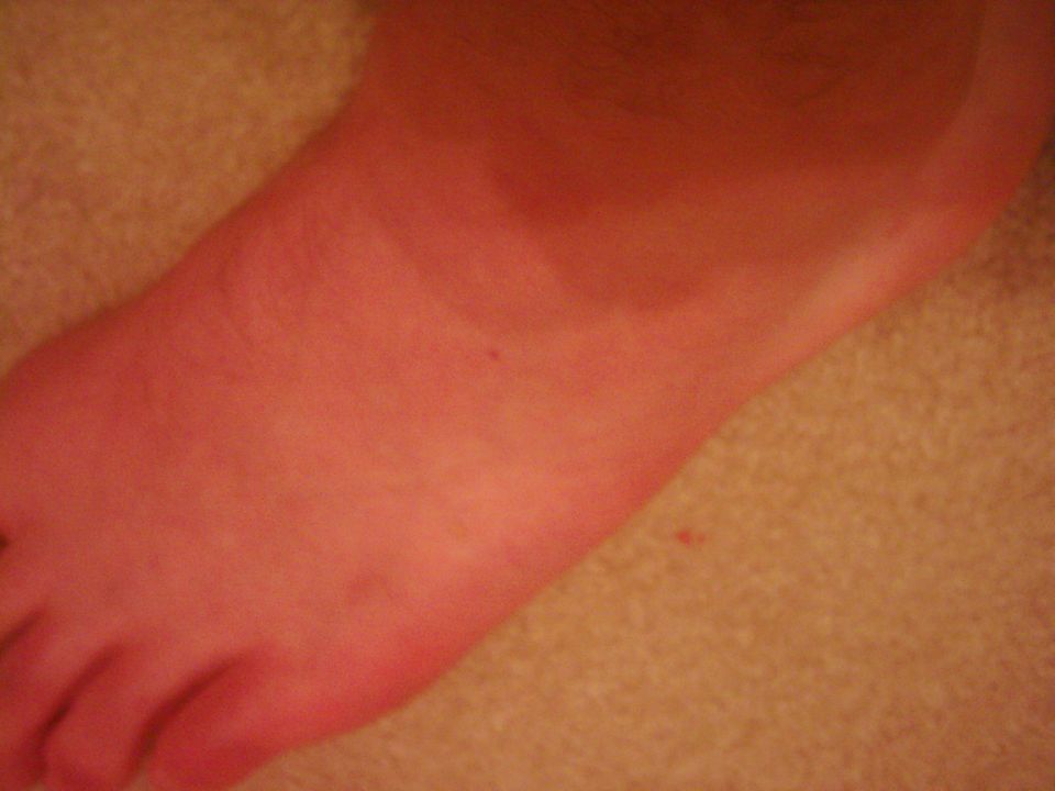 Close-up of a red foot on a tan carpet. Supermotors.net logo in corner