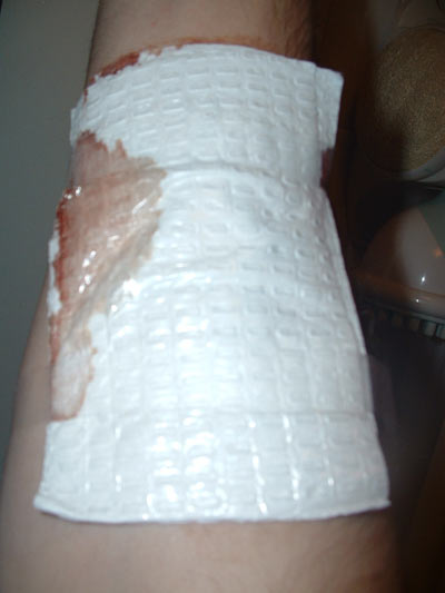 1993 Ford Probe - A bandaged arm shows bloodstains, indicating an injury. Text from a website is visible in the corner.