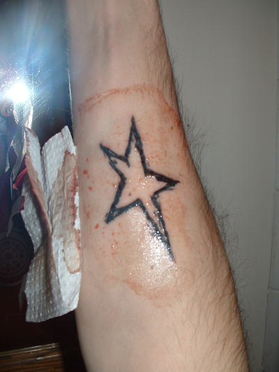 1993 Ford Probe - A tattoo of a star is shown on an arm, with a bloody bandage nearby.