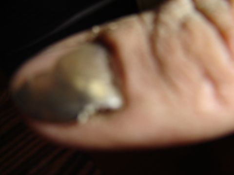 1992 Ford Bronco - A human toe is shown with a metallic object. The Supermotors.net logo is in the corner.