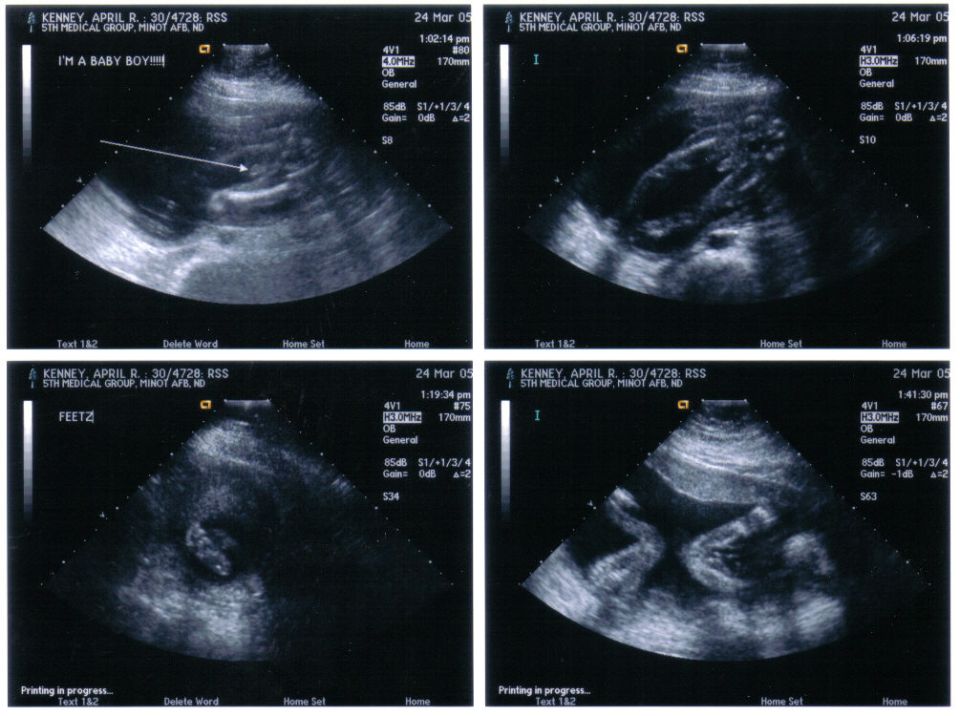 Four-panel prenatal ultrasound printout dated 24 Mar 05, one frame labeled I'M A BABY BOY with arrow