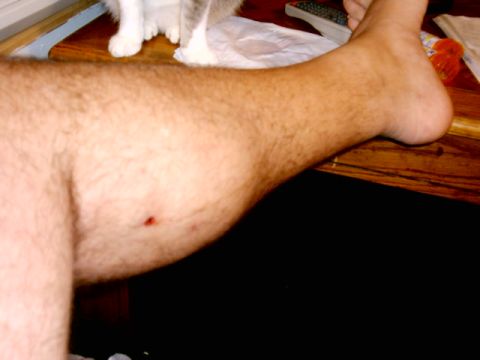 1978 Ford Bronco - A small wound is visible on a hairy leg, with a cat's paws in the background.
